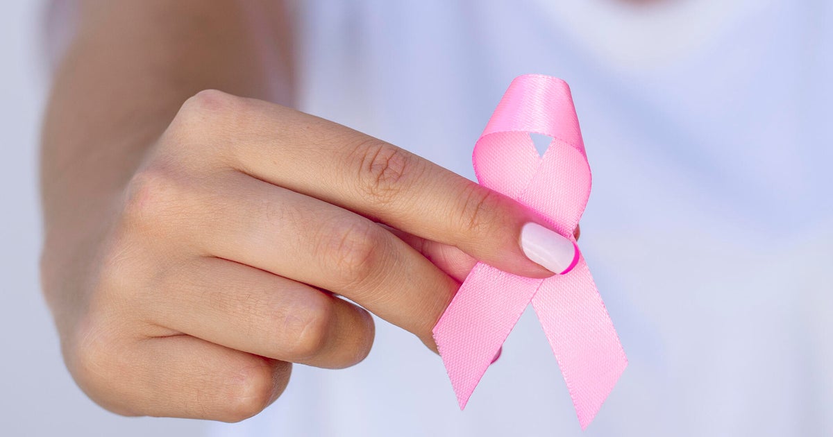 UC Davis Health to offer free mammograms on select days in October