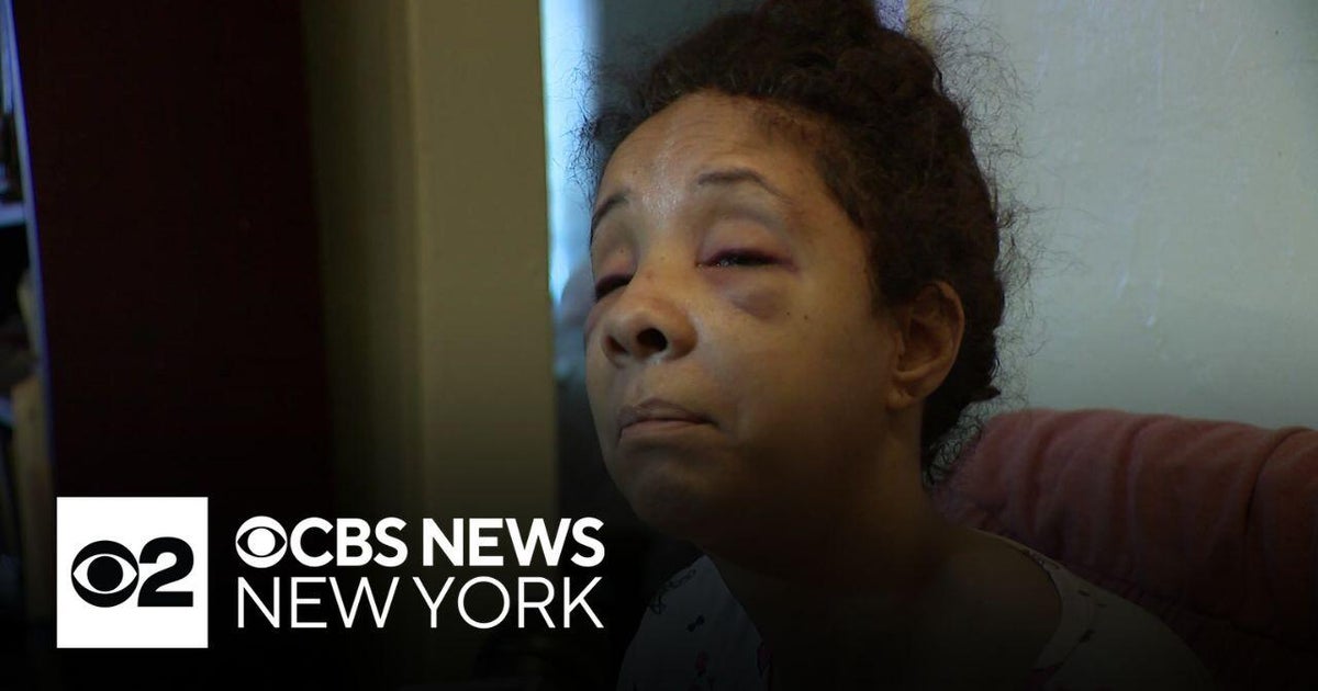 Bronx woman brutally beaten in random attack shares her story - CBS New ...