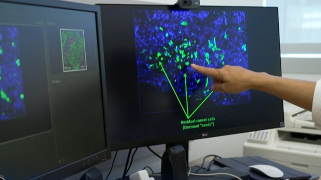 cbsn-fusion-scientists-seek-to-wipe-out-breast-cancers-sleeper-cells-thumbnail.jpg 