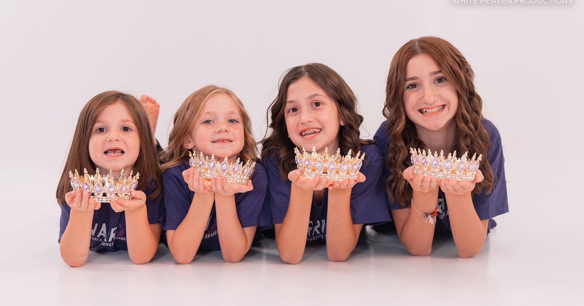4 sisters diagnosed with rare brain condition: "Got to be kidding"