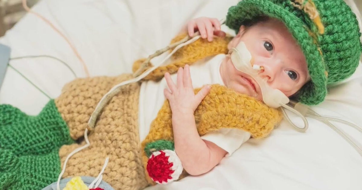 NICU Babies Dressed in Halloween Costumes Across Multiple US Hospitals