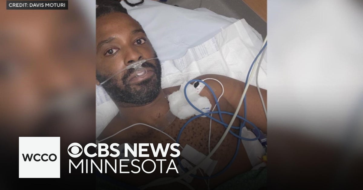 Minneapolis leaders in blame game following neighbor shooting - CBS ...