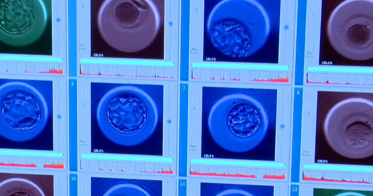 New embryo testing company says it can predict lifespan, height and IQ of potential children