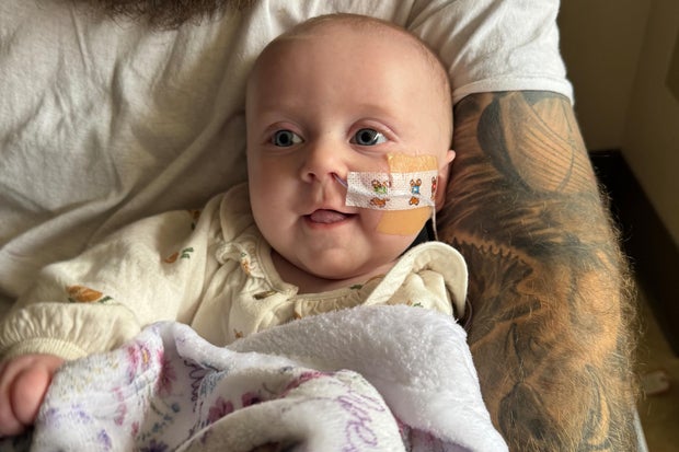 Lembrete de botulismo com fórmula infantil