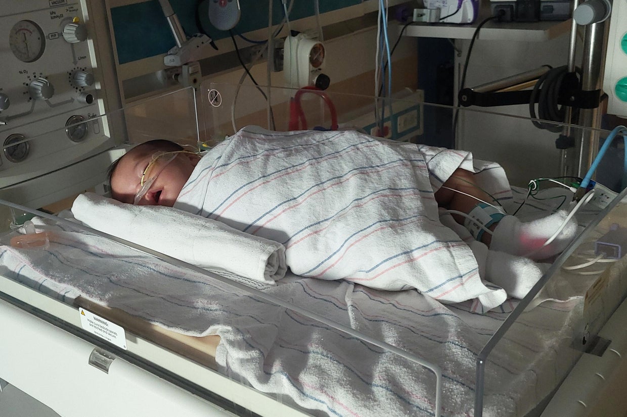 ByHeart sued over recalled formula by families of 4-month-old girls ...