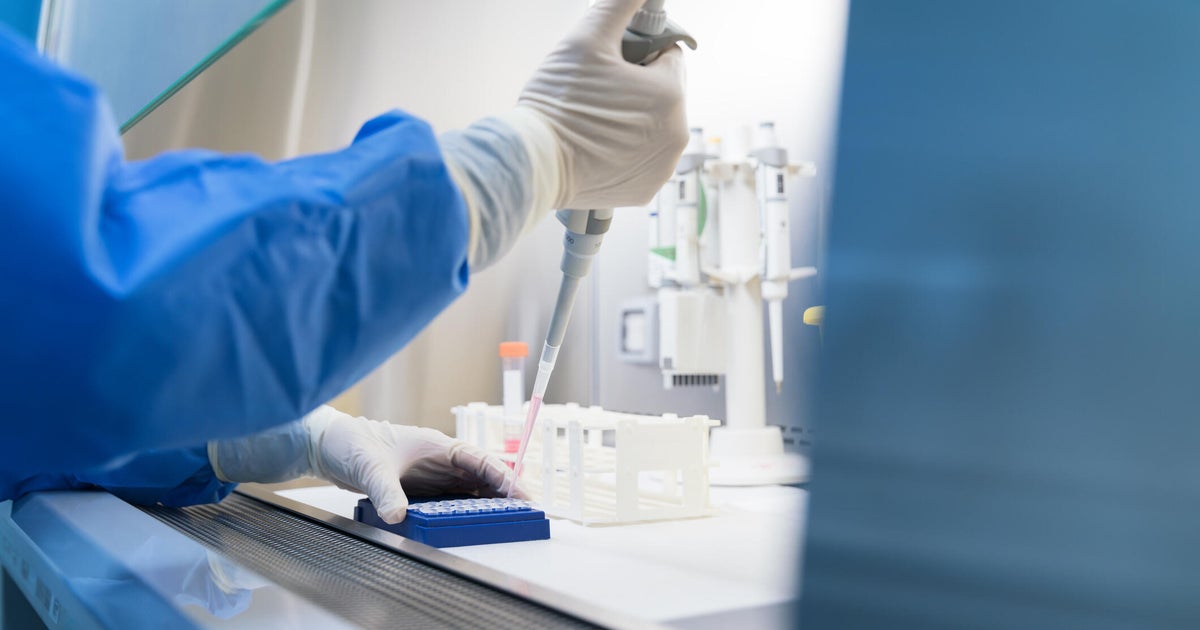 Nearly 1 in 30 clinical trials affected by NIH cuts, paper says