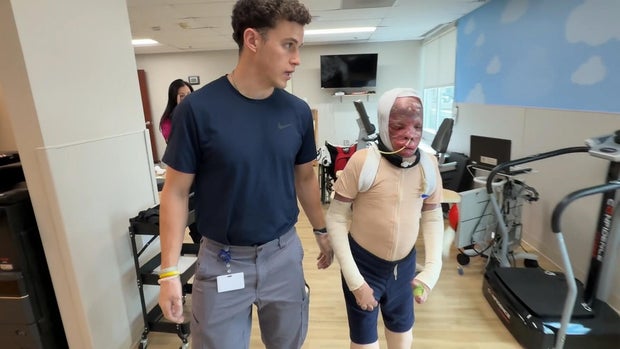 Ramesses Vasquez Viana during physical therapy