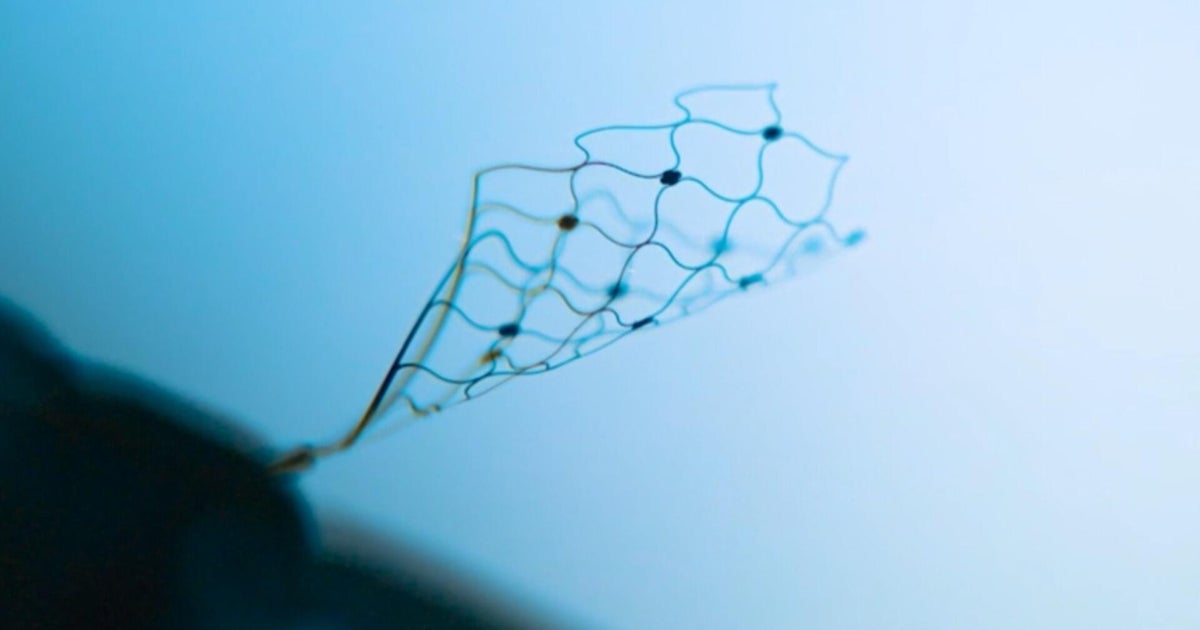 Device connects man's brain to an iPad through Bluetooth