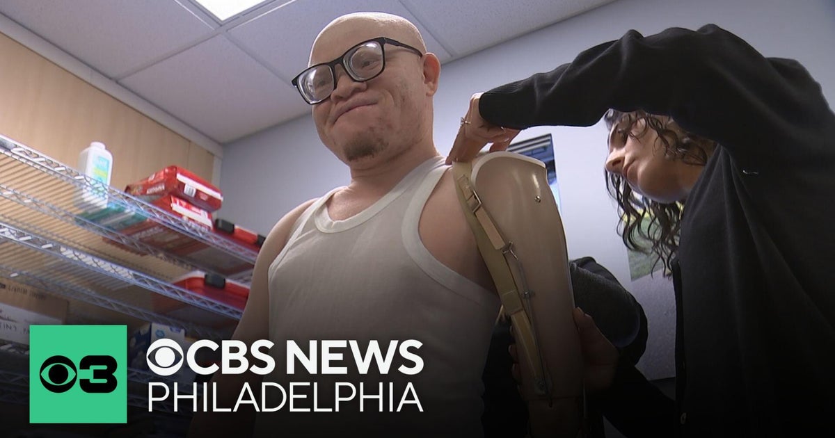 Tanzania people head to South Jersey to get new artificial arms