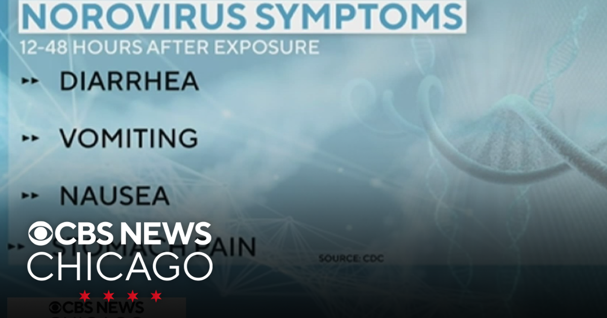Norovirus symptoms and prevention - CBS Chicago