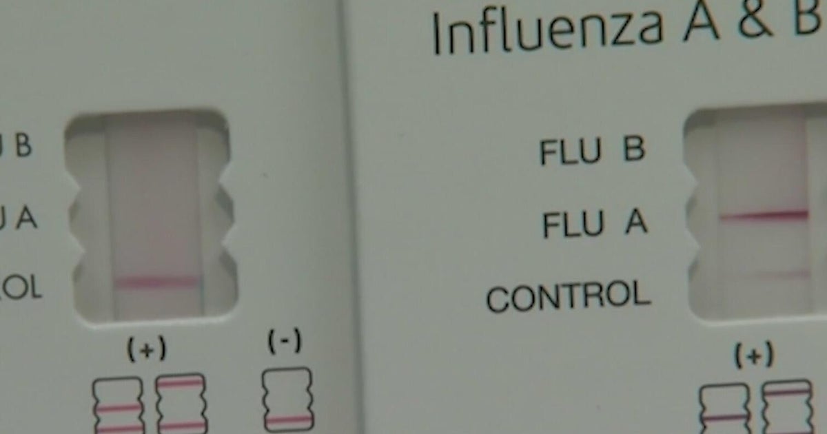 Spike in South Florida flu cases