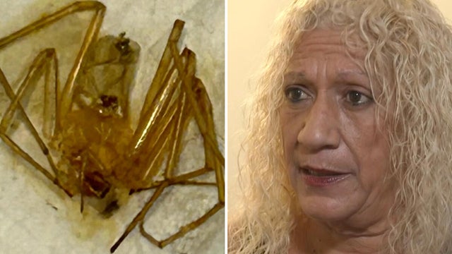 cbsmiami-spider-bites-1.jpg 