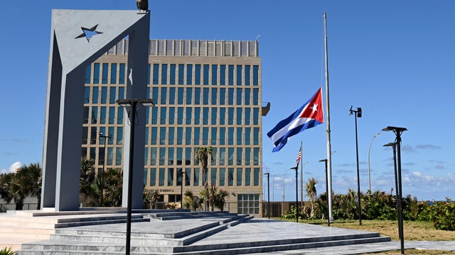 US-NEWS-HAVANA-SYNDROME-MI 