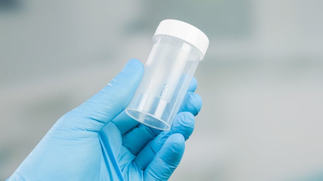 Hand in medical gloves holds a medical probe container 