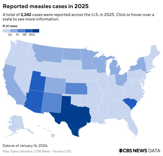 if2bi-reported-measles-cases-in-2025.jpg 