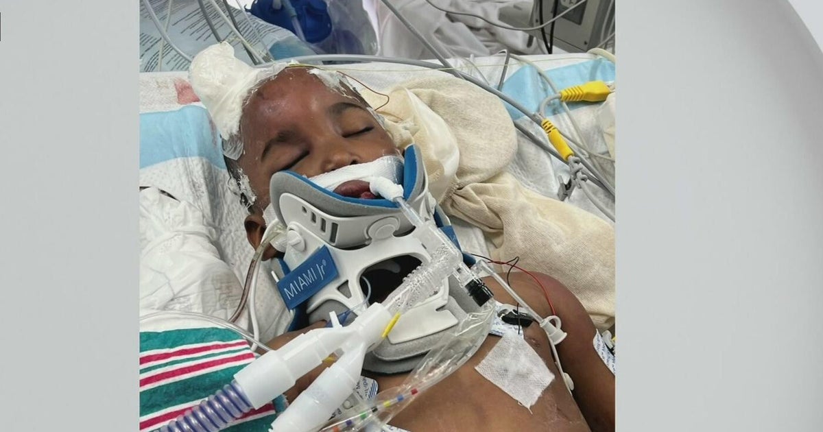 North Miami Beach mother charged after autistic child found severely injured