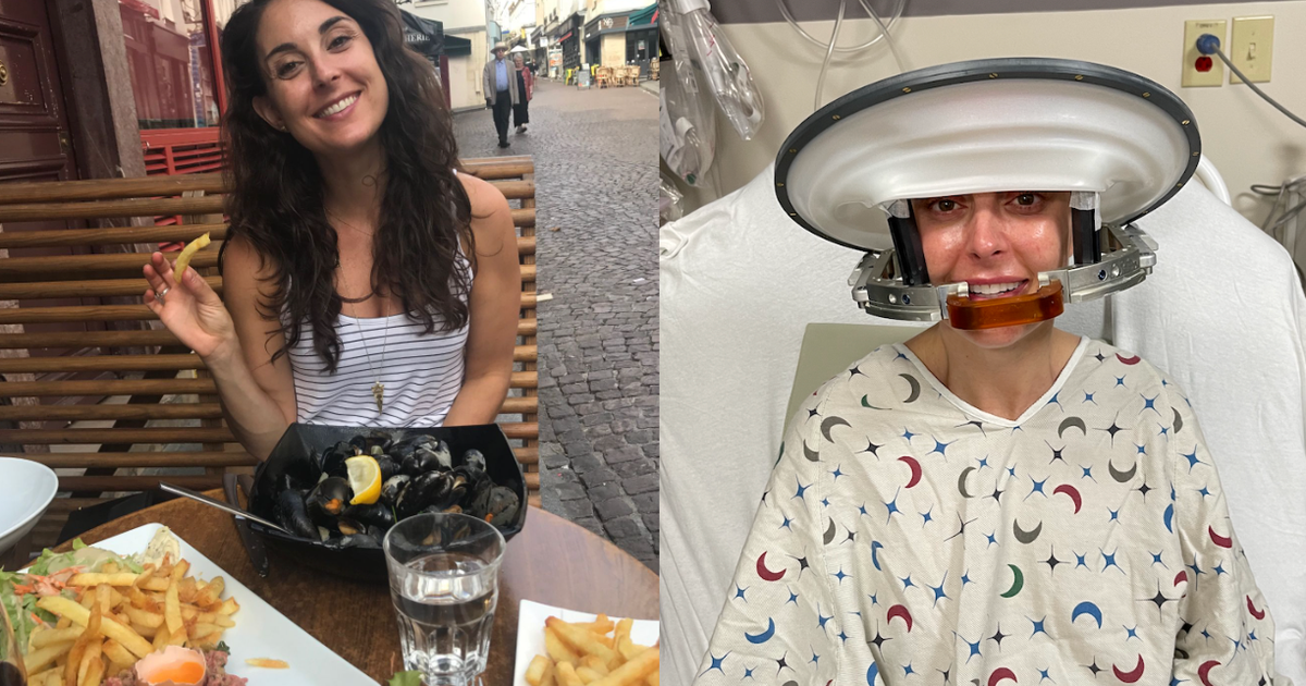 Жена споделя малко вероятния път на оцеляване, след като мигрените доведоха до диагнозата глиобластом: „Аз наистина съм извънредна“