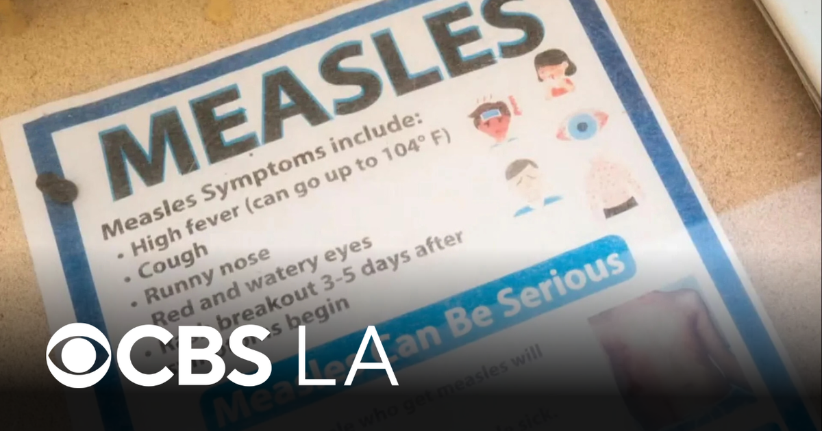 Los Angeles County reports first case of measles in 2026