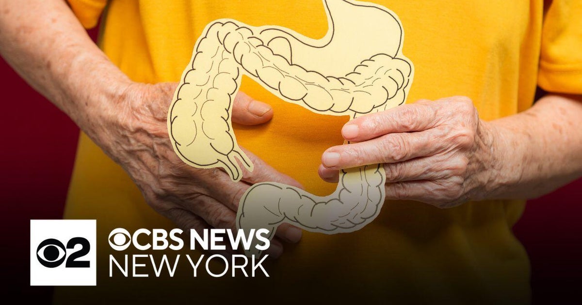 Doctors see rise in colorectal cancer in middle-aged people