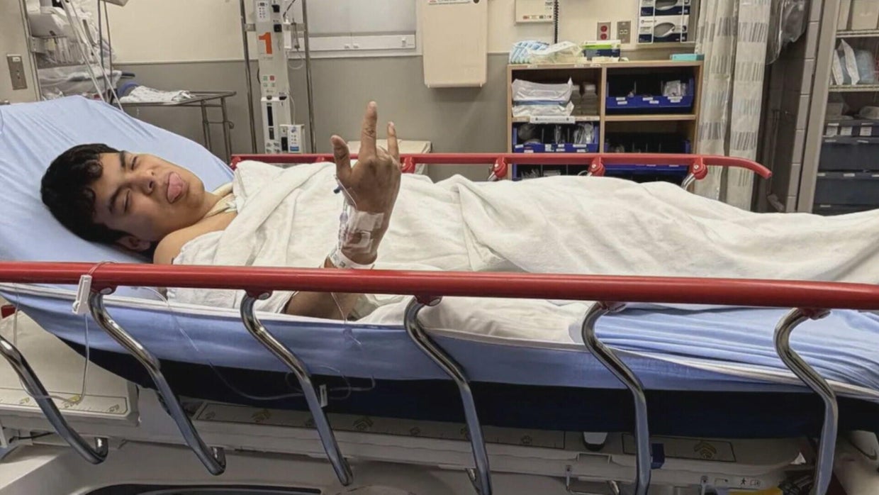Colorado man recovering after friend says he suffered serious injuries ...