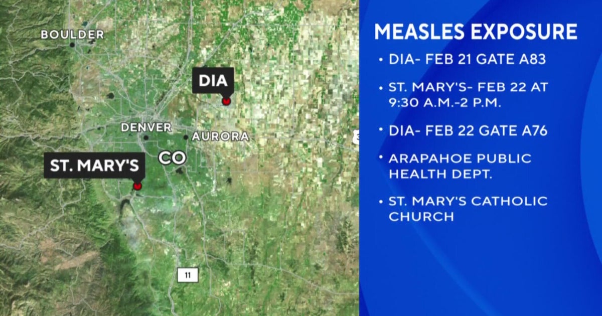 Colorado health officials warn about measles exposure at Denver International Airport