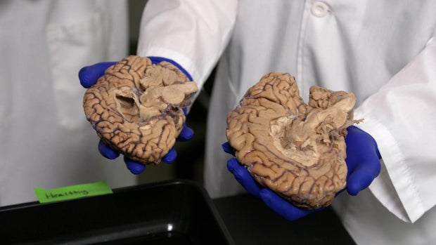 Anderson Cooper holding brains 