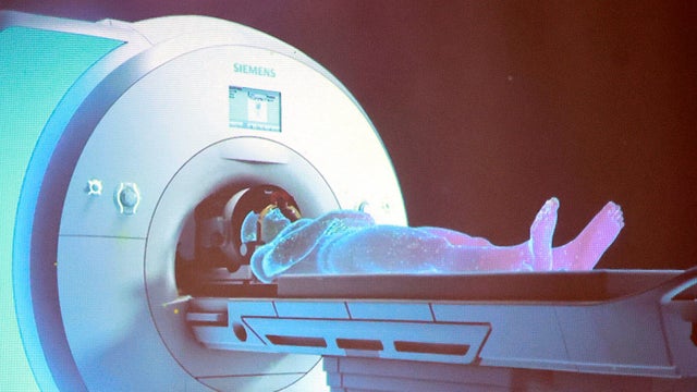 US-NEWS-MED-PARKINSONS-TREATMENT-FL 