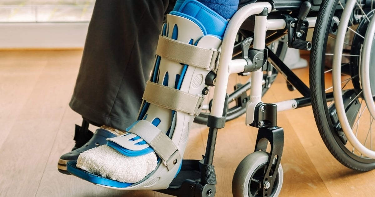 Florida nursing assistant sentenced to 9 years for  million scheme that sent unnecessary braces to seniors