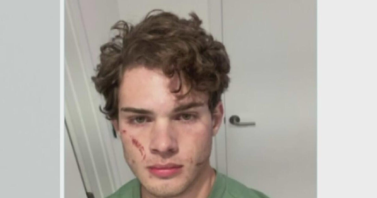 Clavicular responds after suspected overdose during Miami livestream lands him in hospital