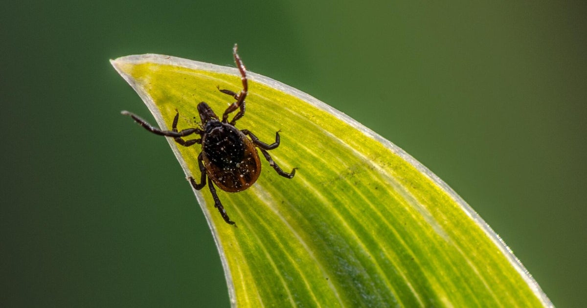 Tick season is sending more people to hospitals. Here’s how you can protect yourself.