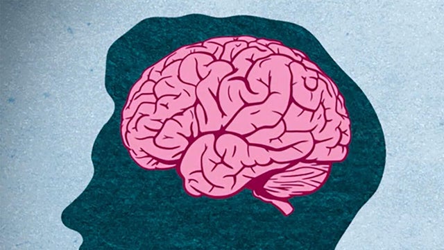 brain-care-1280.jpg 
