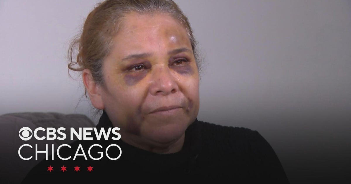 Victim of Family Dollar robbery shares story of attack by accused Swedish Hospital gunman