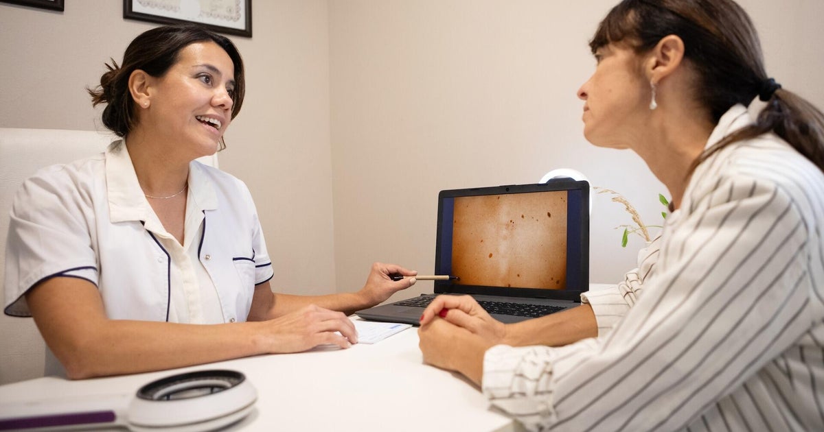 Skin cancer cases rising in the U.S., report says