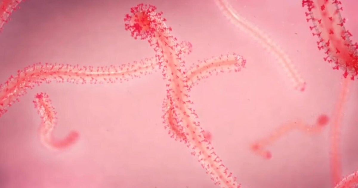 How health officials are responding to Congo Ebola outbreak