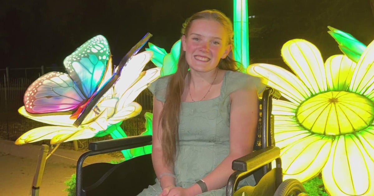 Senior at Denver metro area high school makes prom hours after emergency appendectomy