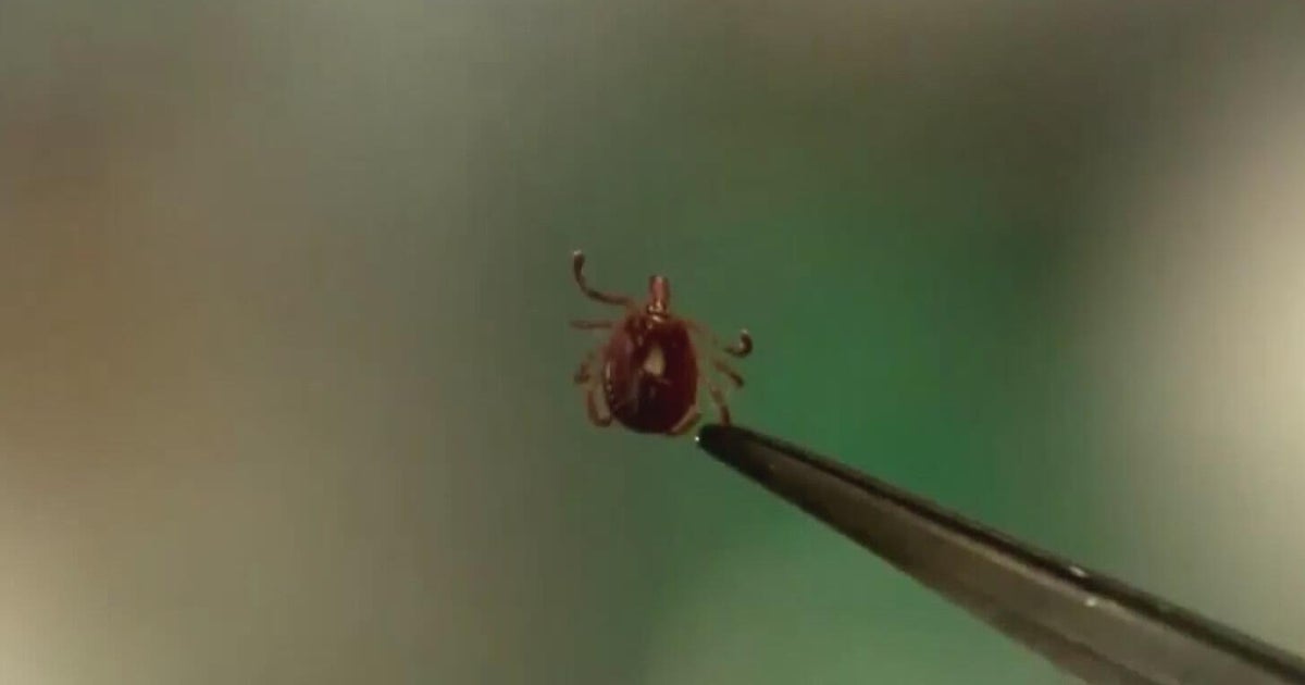 It's shaping up to be a bad tick season, experts warn