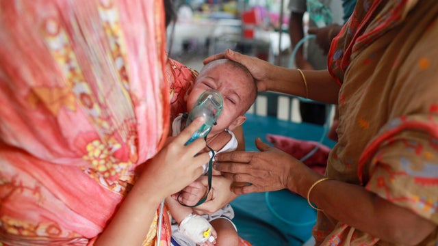 Measles Outbreak in Bangladesh 