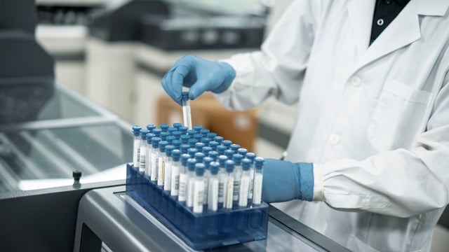 In the laboratory, one hand is operating the test tube experiment 