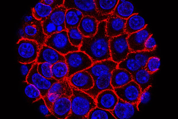 Pancreatic Cancer Drug 