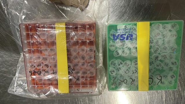 Two researchers charged with allegedly trying to smuggle mpox through DTW 