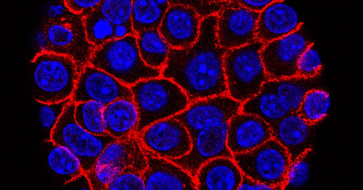 What makes promising pancreatic cancer drug different from chemotherapy?