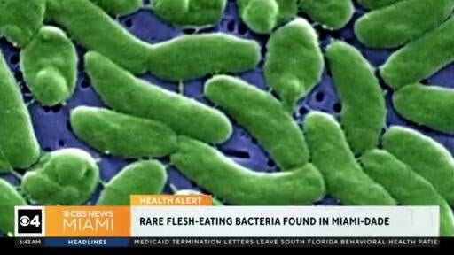 Rare, flesh-eating bacteria confirmed in Miami-Dade, health officials say