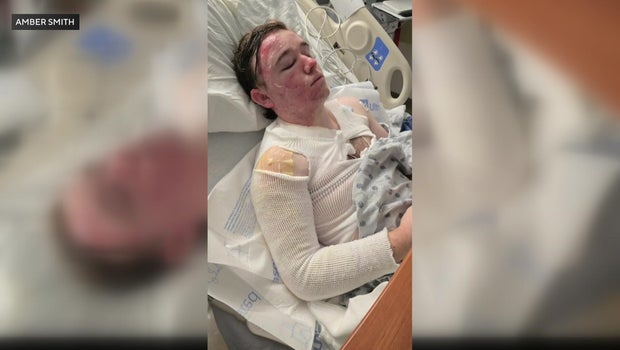 Yuba City McDonald's employee hospitalized after coworker threw hot oil on him, police say