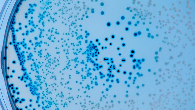 E-Coli Bacteria 
