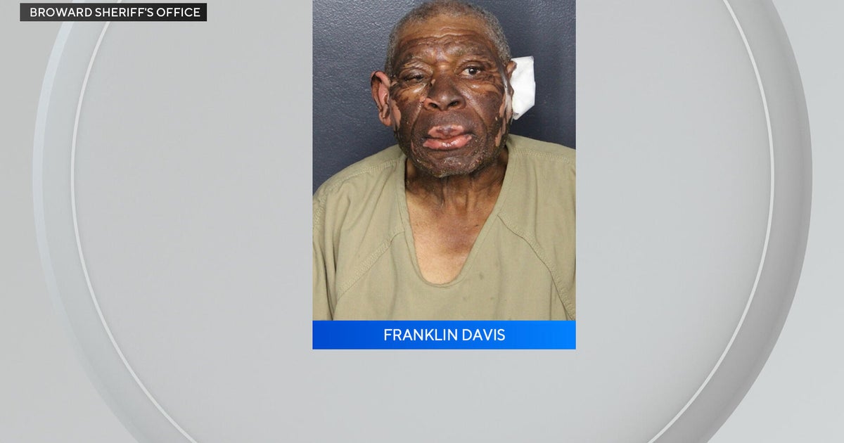 South Florida man set car on fire with woman sitting in back seat ...