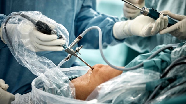 Close up of arthroscopic surgery on knee 
