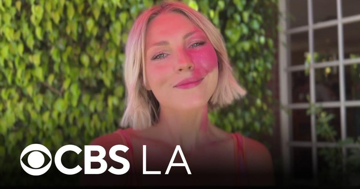 Influencer embraces her birthmark and promotes self-acceptance on social media