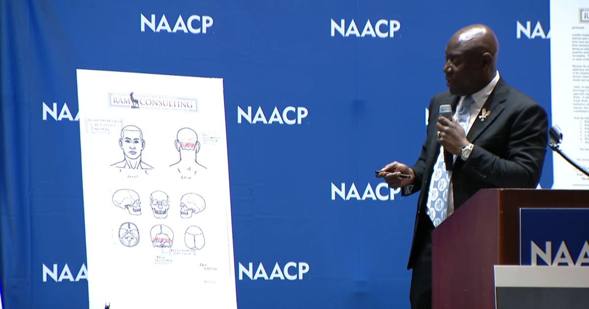 Nolan Wells' preliminary independent autopsy results read by attorney Ben Crump