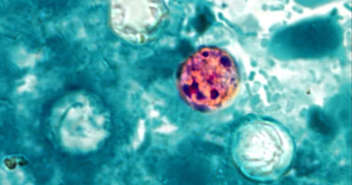 What to know about cyclosporiasis’ lethality after Michigan reports 2 deaths