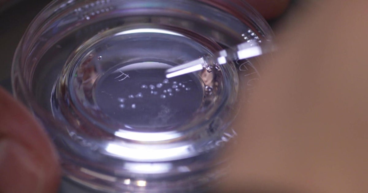 The ins and outs of egg freezing | 60 Minutes Archive